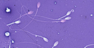 equine semen